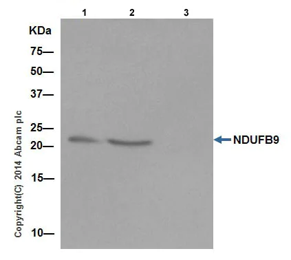 Immunoprecipitation - Anti-NDUFB9 antibody [EPR15955-78] (AB200198)