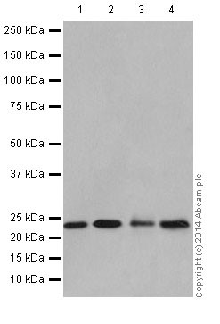 Western blot - Anti-NDUFB9 antibody [EPR15955-78] (AB200198), expandable thumbnail