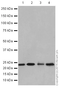 Western blot - Anti-NDUFB9 antibody [EPR15955-78] (AB200198)