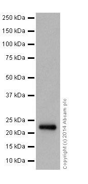 Western blot - Anti-NDUFB9 antibody [EPR15955-78] (AB200198), expandable thumbnail