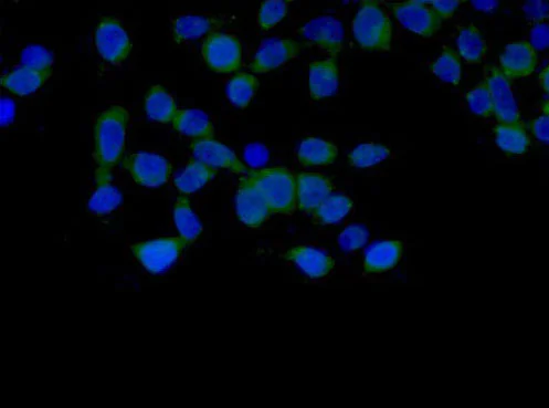Immunocytochemistry/ Immunofluorescence - Anti-NDUFB9 antibody [EPR15955] (AB188581)