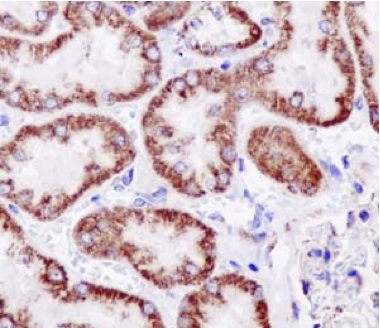 Immunohistochemistry (Formalin/PFA-fixed paraffin-embedded sections) - Anti-NDUFB9 antibody [EPR15955] (AB188581)