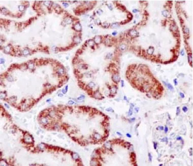 Immunohistochemistry (Formalin/PFA-fixed paraffin-embedded sections) - Anti-NDUFB9 antibody [EPR15955] (AB188581)