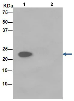 Immunoprecipitation - Anti-NDUFB9 antibody [EPR15955] (AB188581)