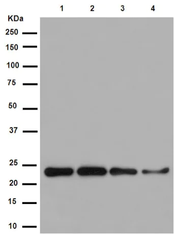 Western blot - Anti-NDUFB9 antibody [EPR15955] (AB188581)