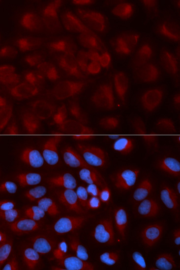 Immunocytochemistry/ Immunofluorescence - Anti-Ndufs1 antibody (AB185733)