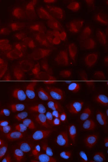 Immunocytochemistry/ Immunofluorescence - Anti-Ndufs1 antibody (AB185733)