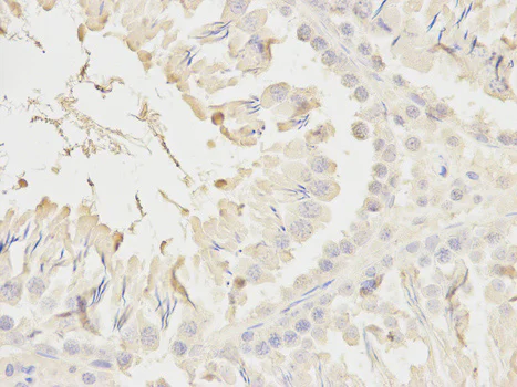 Immunohistochemistry (Formalin/PFA-fixed paraffin-embedded sections) - Anti-Ndufs1 antibody (AB185733)