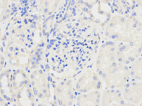 Immunohistochemistry (Formalin/PFA-fixed paraffin-embedded sections) - Anti-Ndufs1 antibody (AB185733)