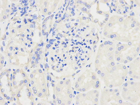 Immunohistochemistry (Formalin/PFA-fixed paraffin-embedded sections) - Anti-Ndufs1 antibody (AB185733)