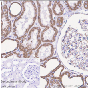 Immunohistochemistry (Formalin/PFA-fixed paraffin-embedded sections) - Anti-Ndufs1 antibody [EPR11521(B)] (AB169540), expandable thumbnail