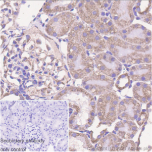 Immunohistochemistry (Formalin/PFA-fixed paraffin-embedded sections) - Anti-Ndufs1 antibody [EPR11521(B)] (AB169540), expandable thumbnail