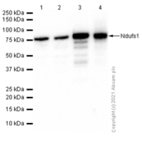 Western blot - Anti-Ndufs1 antibody [EPR11521(B)] (ab169540), expandable thumbnail