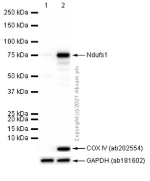 Western blot - Anti-Ndufs1 antibody [EPR11521(B)] (ab169540), expandable thumbnail