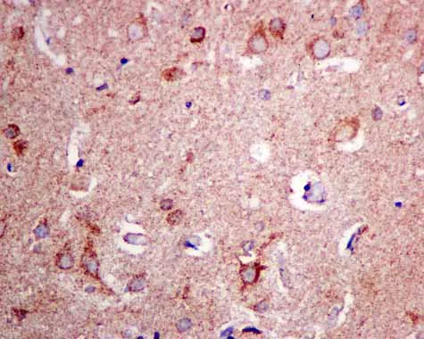 Immunohistochemistry (Formalin/PFA-fixed paraffin-embedded sections) - Anti-Ndufs1 antibody [EPR11522(B)] - BSA and Azide free (AB249321)