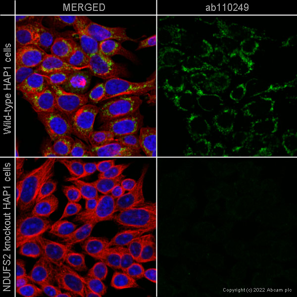 Immunocytochemistry/ Immunofluorescence - Anti-NDUFS2 antibody [7A12BE5AD5] (AB110249)