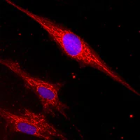 Immunocytochemistry/ Immunofluorescence - Anti-NDUFS2 antibody [7A12BE5AD5] (AB110249)