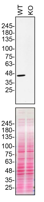Western blot - Anti-NDUFS2 antibody [7A12BE5AD5] (AB110249)