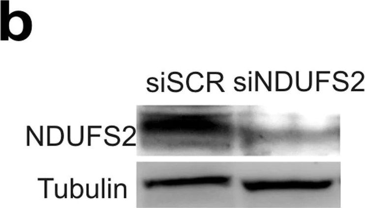 Western blot - Anti-NDUFS2 antibody [7A12BE5AD5] (AB110249)