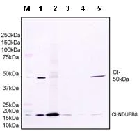 Western blot - Anti-NDUFS2 antibody [7A12BE5AD5] (AB110249)