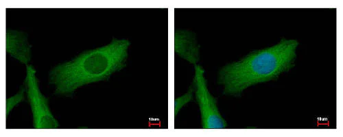 Immunocytochemistry/ Immunofluorescence - Anti-NDUFS2 antibody (AB192764)