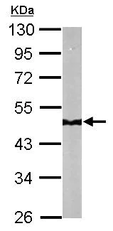 Western blot - Anti-NDUFS2 antibody (AB192764)