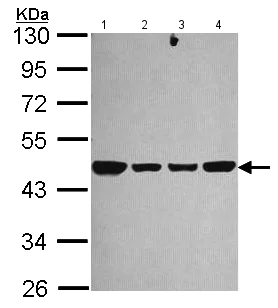 Western blot - Anti-NDUFS2 antibody (AB192764)