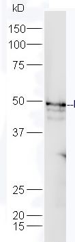 Western blot - Anti-NDUFS2 antibody (AB216510)