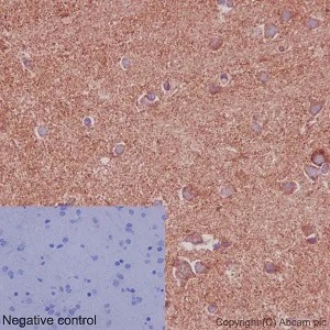 Immunohistochemistry (Formalin/PFA-fixed paraffin-embedded sections) - Anti-NDUFS2 antibody [EPR16266] (AB192022)
