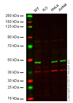 Western blot - Anti-NDUFS2 antibody [EPR16266] (AB192022)