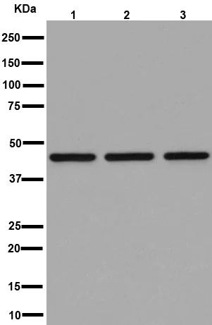 Western blot - Anti-NDUFS2 antibody [EPR16266] (AB192022)