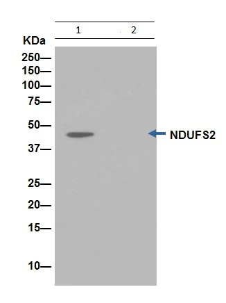 Immunoprecipitation - Anti-NDUFS2 antibody [EPR16266] - BSA and Azide free (AB251104)