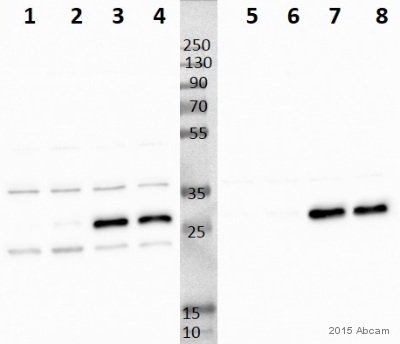 Western blot - Anti-NDUFS3 antibody [17D95] (AB14711), expandable thumbnail