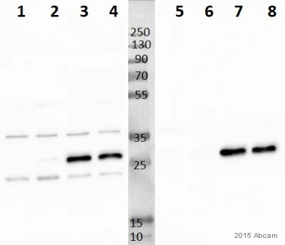 Western blot - Anti-NDUFS3 antibody [17D95] (AB14711)