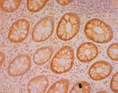 Immunohistochemistry (Formalin/PFA-fixed paraffin-embedded sections) - Anti-NDUFS3 antibody [3F9DD2] (AB110246)