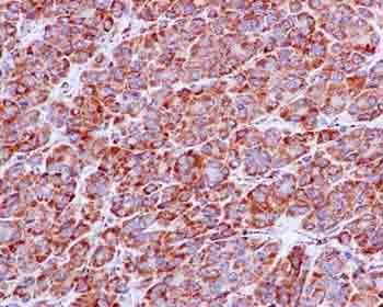 Immunohistochemistry (Formalin/PFA-fixed paraffin-embedded sections) - Anti-NDUFS3 antibody [EPR12781] (AB183733)