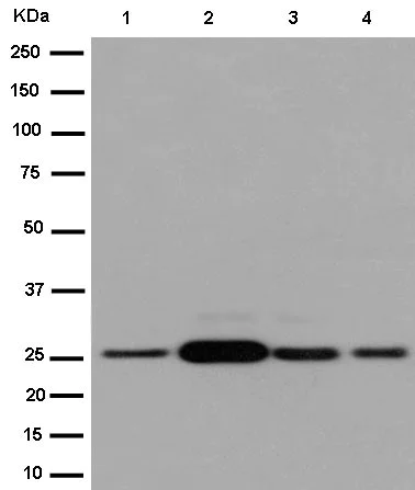 Western blot - Anti-NDUFS3 antibody [EPR12781] (AB183733)