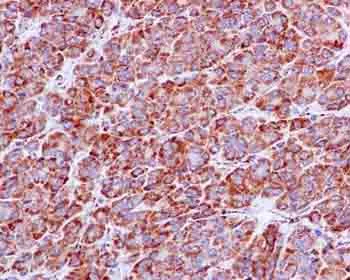 Immunohistochemistry (Formalin/PFA-fixed paraffin-embedded sections) - Anti-NDUFS3 antibody [EPR12781] - BSA and Azide free (AB240276)