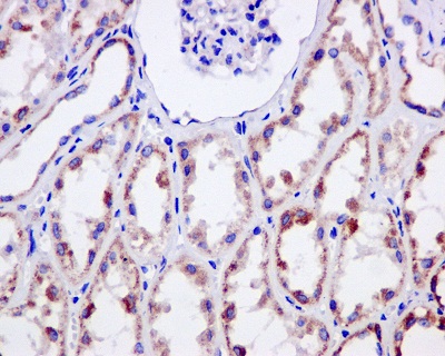 Immunohistochemistry (Formalin/PFA-fixed paraffin-embedded sections) - Anti-NDUFS3 antibody [EPR12782] - BSA and Azide free (ab249976), expandable thumbnail