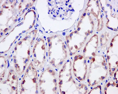 Immunohistochemistry (Formalin/PFA-fixed paraffin-embedded sections) - Anti-NDUFS3 antibody [EPR12782] - C-terminal (AB177471)