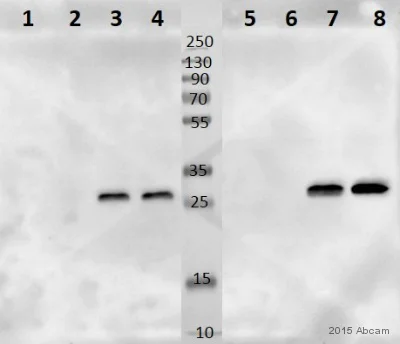 Western blot - Anti-NDUFS3 antibody [EPR12782] - C-terminal (AB177471)