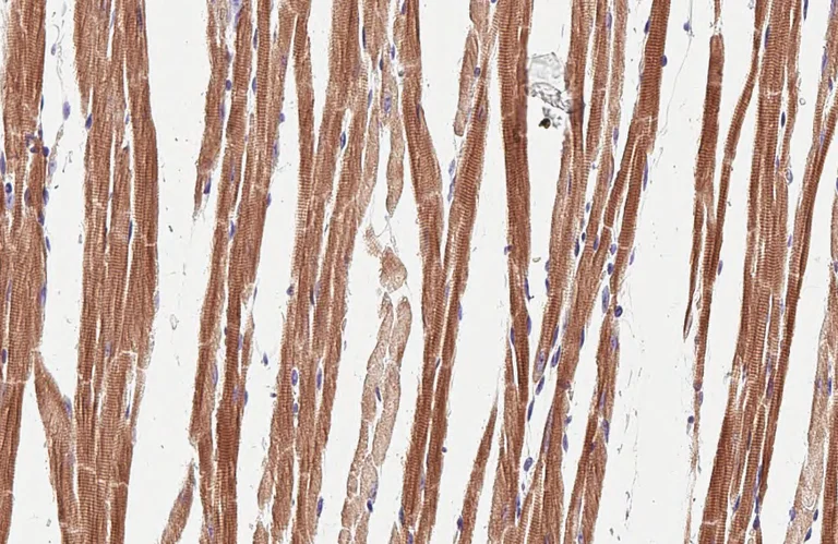 Immunohistochemistry (Formalin/PFA-fixed paraffin-embedded sections) - Anti-NDUFS3 antibody [HL2097] (AB317137)
