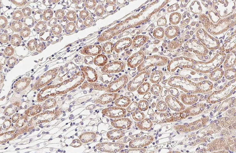 Immunohistochemistry (Formalin/PFA-fixed paraffin-embedded sections) - Anti-NDUFS3 antibody [HL2097] (AB317137)