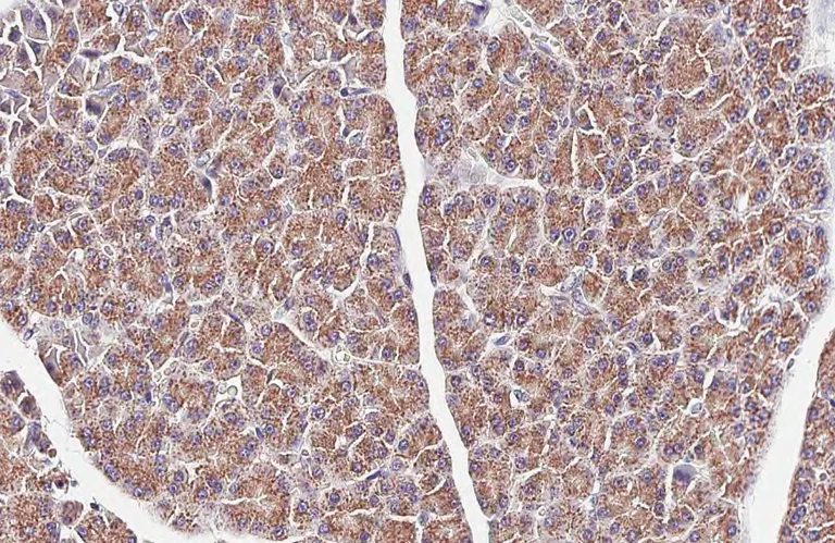 Immunohistochemistry (Formalin/PFA-fixed paraffin-embedded sections) - Anti-NDUFS3 antibody [HL2097] (AB317137)