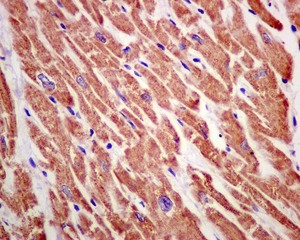 Immunohistochemistry (Formalin/PFA-fixed paraffin-embedded sections) - Anti-NDUFS5 antibody [EPR12291] (AB179806)