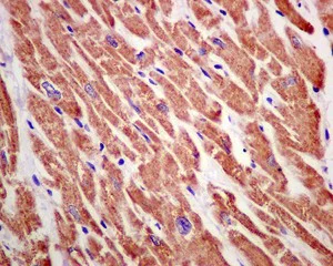 Immunohistochemistry (Formalin/PFA-fixed paraffin-embedded sections) - Anti-NDUFS5 antibody [EPR12291] - BSA and Azide free (AB250112)