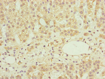 Immunohistochemistry (Formalin/PFA-fixed paraffin-embedded sections) - Anti-NDUFS6 antibody (AB230464)
