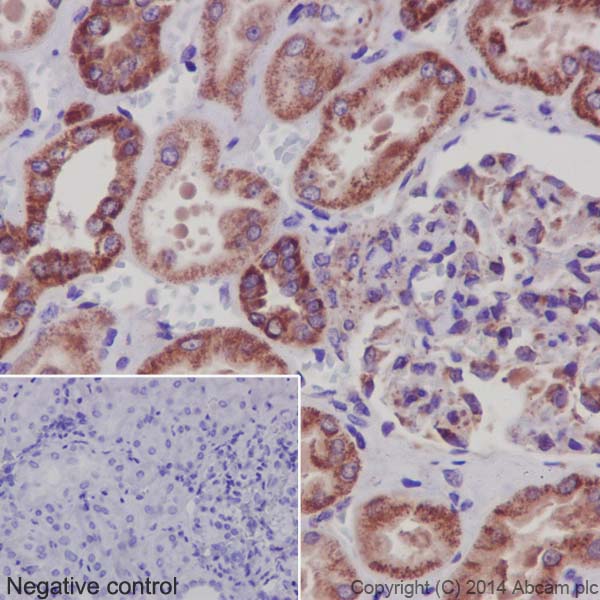 Immunohistochemistry (Formalin/PFA-fixed paraffin-embedded sections) - Anti-NDUFS6 antibody [EPR15957-37] - BSA and Azide free (AB251211), expandable thumbnail