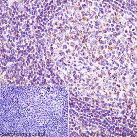 Immunohistochemistry (Formalin/PFA-fixed paraffin-embedded sections) - Anti-NDUFS6 antibody [EPR15957] (AB195807), expandable thumbnail