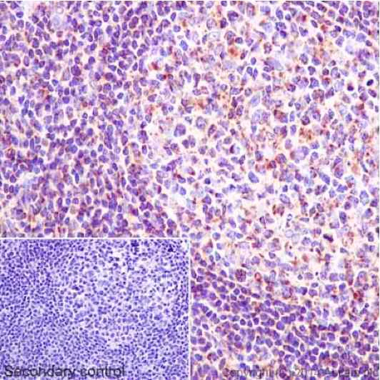 Immunohistochemistry (Formalin/PFA-fixed paraffin-embedded sections) - Anti-NDUFS6 antibody [EPR15957] (AB195807)